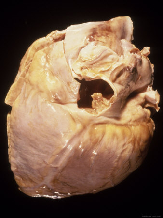 human heart art. Human Heart Normal