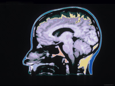 mri brain scan. Color MRI Scan Head Skull