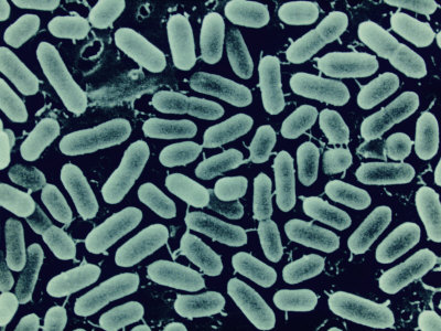 bacteria canned listeria poisoning monocytogenes which