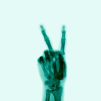 X-Ray of Hand Doing Peace Sign Photographic Print!