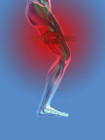 Nerve Pain: Leg Ulcer Nerve Pain
