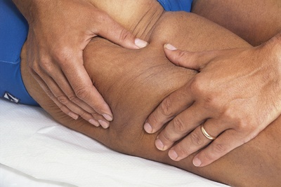 Cellulitis - Pictures, posters, news and videos on your pursuit 
