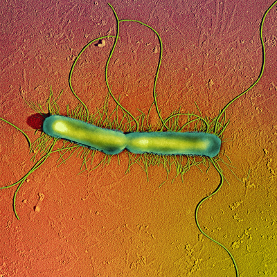 Proteus Vulgaris Bacteria, SEM Photographic Print by Thomas Deerinck!