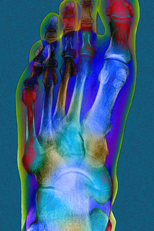Normal Foot, X-ray Photographic Print by Du Cane Medical