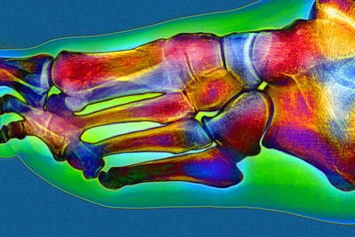 Normal Foot, X-ray Photographic Print by Du Cane Medical