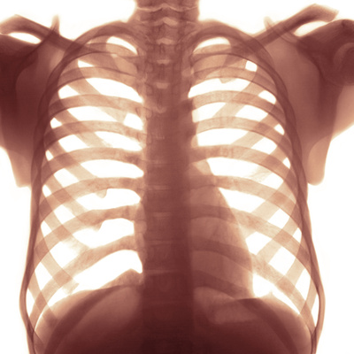 Chest X-ray of a Healhty Human Heart Photographic Print by Science Photo Library