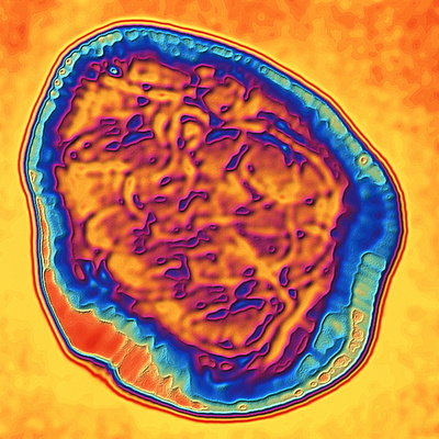 Coloured TEM of the Measles Virus (morbilli-virus) Photographic Print by  PASIEKA