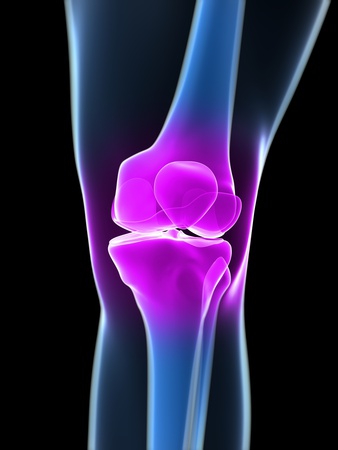 Knee Pain, Conceptual Artwork Photographic Print by  SCIEPRO