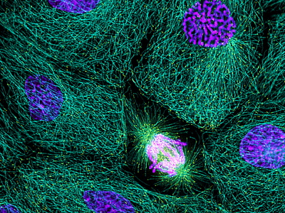 Mitosis Photographic Print by Dr. Torsten Wittmann