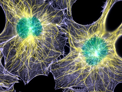 Fibroblast Cells Showing Cytoskeleton Photographic Print by Dr. Torsten Wittmann