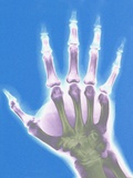 X-ray of a Hand Photographie