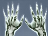 X-ray of Hands Fotografie-Druck