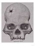 Trepanned Skull, from Incidents of Travel and Exploration in the Land of the Incas Giclee Print