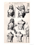 Operating on Breast Cancer, from Operating on Breast Cancer, from