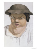 Endemic Scrofula, Illustration from a Book by Baron Jean Louis Alibert Giclee Print by Salvadore Tresca