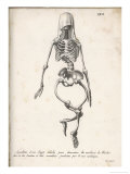 Skeleton of an Adult Patient Afflicted with Rickets Giclee Print by Langlume 