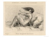 Mental Patient at la Salpetriere Going Through the Phase of Large Movements Giclee Print by P. Richer