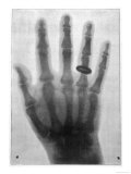 Photograph Taken by Dr. Voller of Hamburg Using the Roentgen System Giclee Print