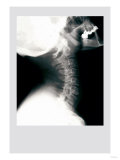 Skull and Neck Print