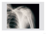Shoulder Posters