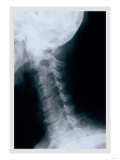 Neck Prints