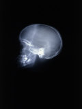 X-Ray of Skull Photographic Print by Rick Kooker