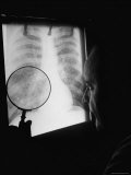 Doctor Looking at X-Ray Photograph Taken of Coal Miner Premium Photographic Print by Nat Farbman