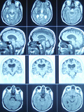 Cat Scan Images of Brain Photographic Print