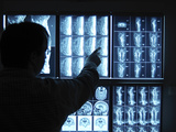 Doctor Pointing to X-Ray Images on Computer Screen Photographic Print