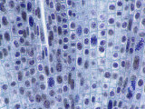 Mitosis in Onion Root Tip Cells Fotografisk tryk af David M. Dennis Mitosis in Onion Root Tip Cells Fotografisk tryk af David M. Dennis