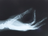 Close-up of X-Ray Photograph of Hand Photographic Print