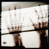 X-Ray Photograph of Person's Hands on Keyboard Photographic Print