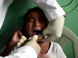 A Girl, 6, Cries as Dentist Allan Castellanos Removes a Molar Toot Photographic Print