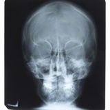 X-Ray Photograph of Skull Photographic Print