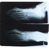 X-Ray Photograph of Person's Feet Photographic Print X-Ray Photograph of Person's Feet Photographic Print