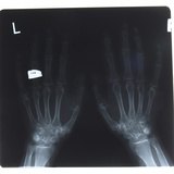 Close-up of X-Ray Photograph of Hands Photographic Print
