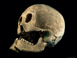A skull with a bronze arrowhead embedded in the bone Lámina fotográfica A skull with a bronze arrowhead embedded in the bone Lámina fotográfica