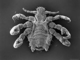 Scanning Electron Microscopic View of a Crab Louse Photographic Print