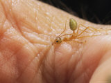 A Green Tree Ant Squirts Acid into a Bite on a Human Skin Photographic Print