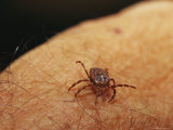Grass or Bull Dog Tick on a Human Arm Lámina fotográfica Grass or Bull Dog Tick on a Human Arm Lámina fotográfica