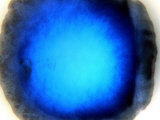 Mycobacterium Xenopi Photographic Print by Dr. Luis De La Maza