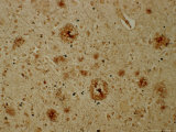 Alzheimers Disease, Bielchowsky Stain X64 Photographic Print by G. W. Willis