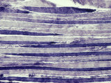 Normal Human Skeletal Muscle Photographic Print by G. W. Willis