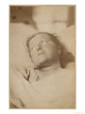 Hysterical Epilepsy, Paris, c.1876 Giclee Print by Paul Regnard