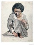 Total Cretinism, from a Book by Baron Jean Louis Alibert Reproduction procédé giclée par Salvadore Tresca