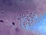 Candida Albicans Germ Tube Photographic Print