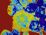 HIV Infected T-Cells AIDS Virus Photographic Print