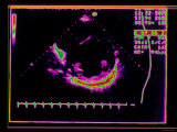 Echocardiogram, Hypertension Photographic Print