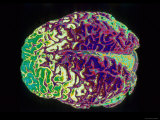 Human Brain Colorized Photographic Print