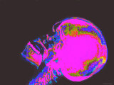 X-Ray Normal Human Skull Head Face Brain Neurology Lámina fotográfica